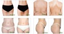 Beauty Body System CRYOLIPO Zsírfagyasztó gép | BBS-86