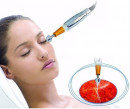 Beauty Body System Tű Nélküli Mezoterápiás Anti-aging gép | BBS-1011