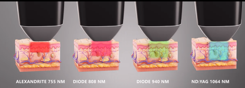 Gran Beauty Laser GBL600 több hullámhosszal